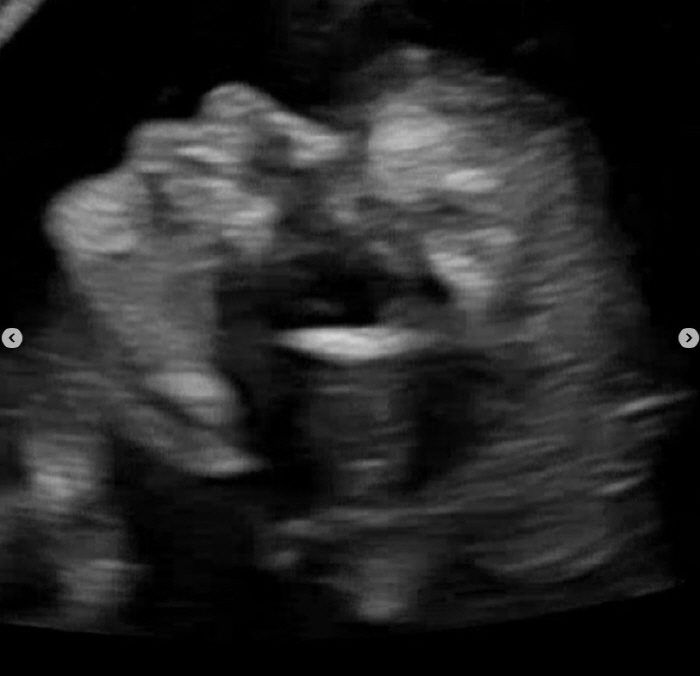 '하시2' 김도균, 아빠 된다…결혼 3년만 경사 "건강하게만 자라줘"