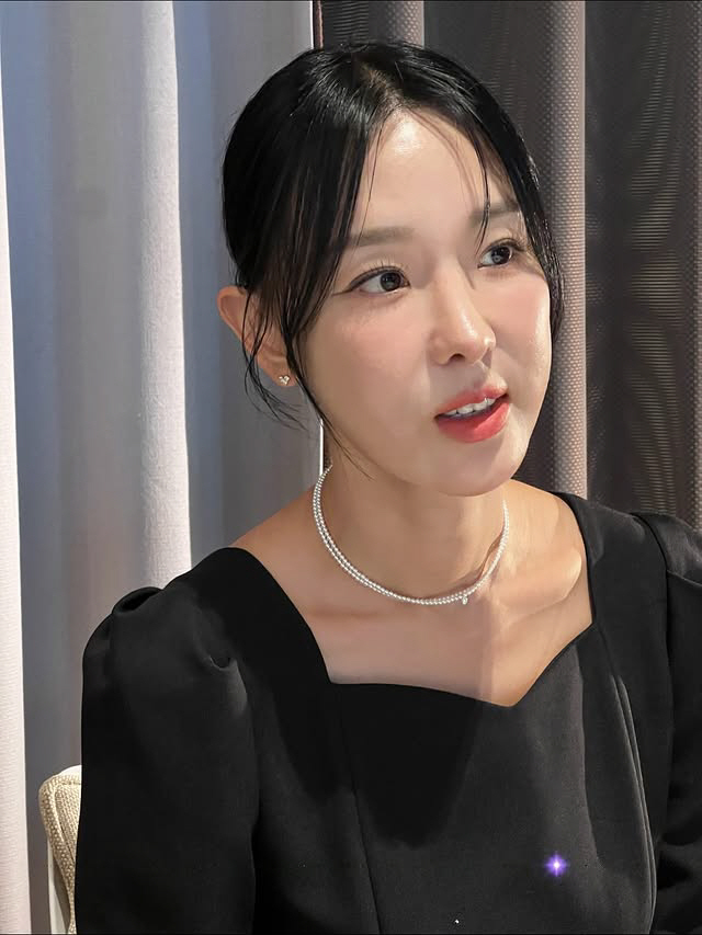 "입 계속 벌어져" 이지혜, 인중축소술 후 '부자연스러운 얼굴' 어쩌나