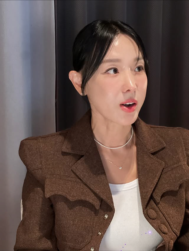 "입 계속 벌어져" 이지혜, 인중축소술 후 '부자연스러운 얼굴' 어쩌나