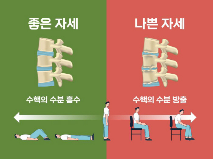 나이 들수록 키 줄어드는 이유, 힘찬병원 "척추질환 때문 가능성"
