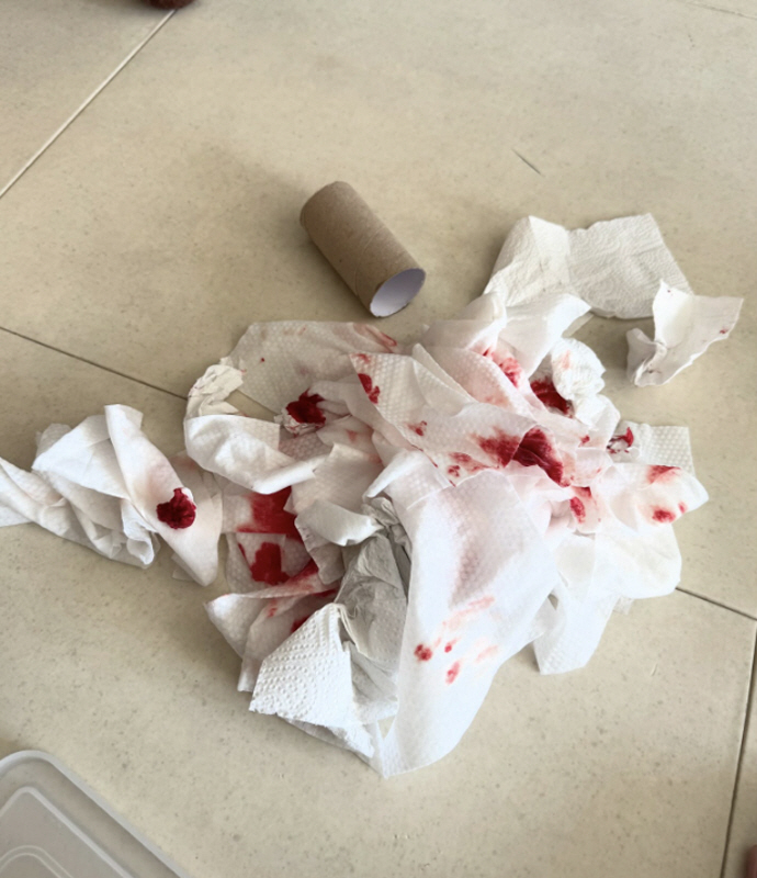 자이언트 핑크, 피 묻은 휴지 사진 공개.."도와주세요"