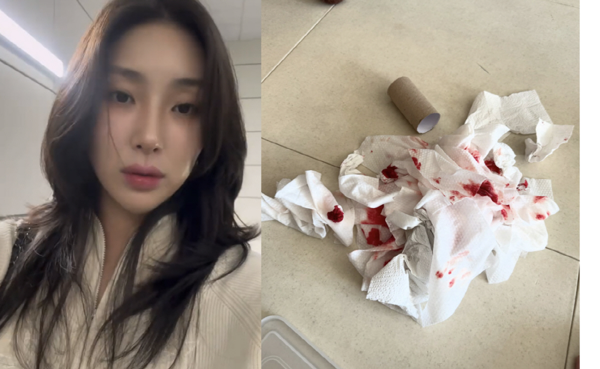 자이언트 핑크, 피 묻은 휴지 사진 공개.."도와주세요"