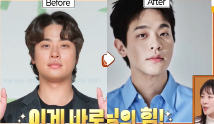 박정민, '15kg 감량'하고 확 달라진 얼굴 "매일 20km 뛰었다"