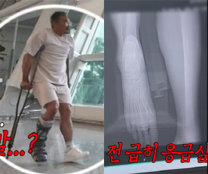 추성훈, 촬영 중 중상 입고 응급실行 