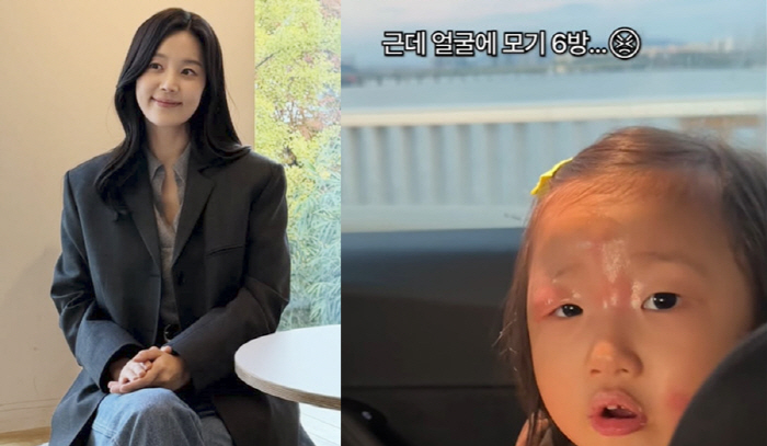 한지혜, 4세 딸 심하게 퉁퉁 부은 눈에 속상함 토로..."모기 6방. …