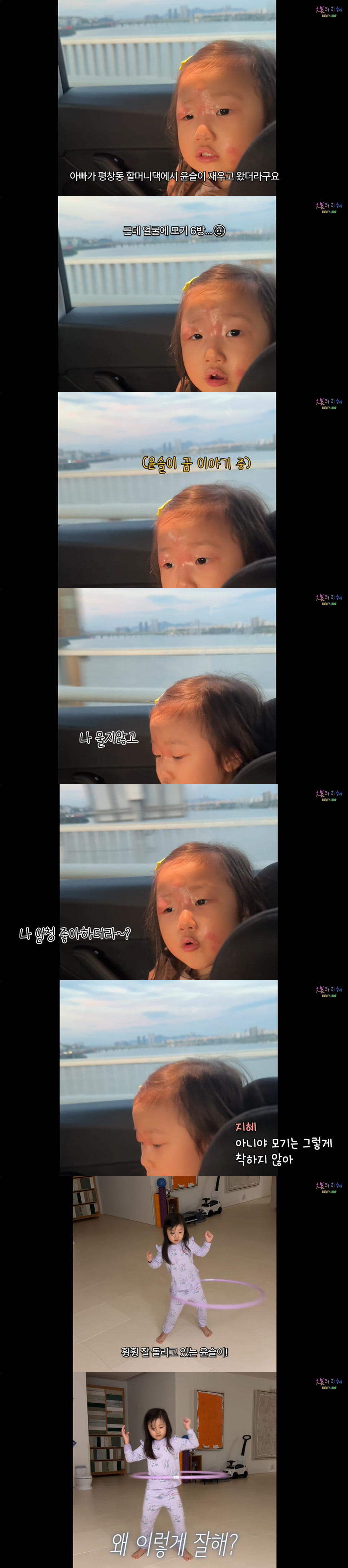 한지혜, 4세 딸 심하게 퉁퉁 부은 눈에 속상함 토로..."모기 6방. …