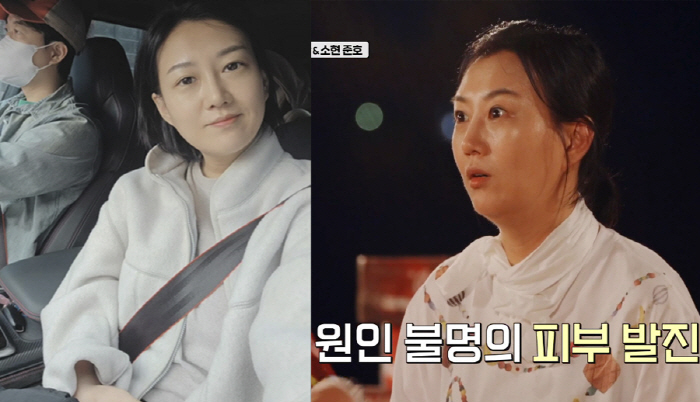 장윤정, '아파서 사족보행' 건강 이상 고백 후 근황..."날아다닙니다"