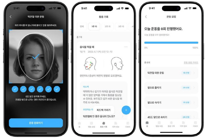 스마트폰 앱으로 턱관절장애 치료 효과 세계 최초 입증
