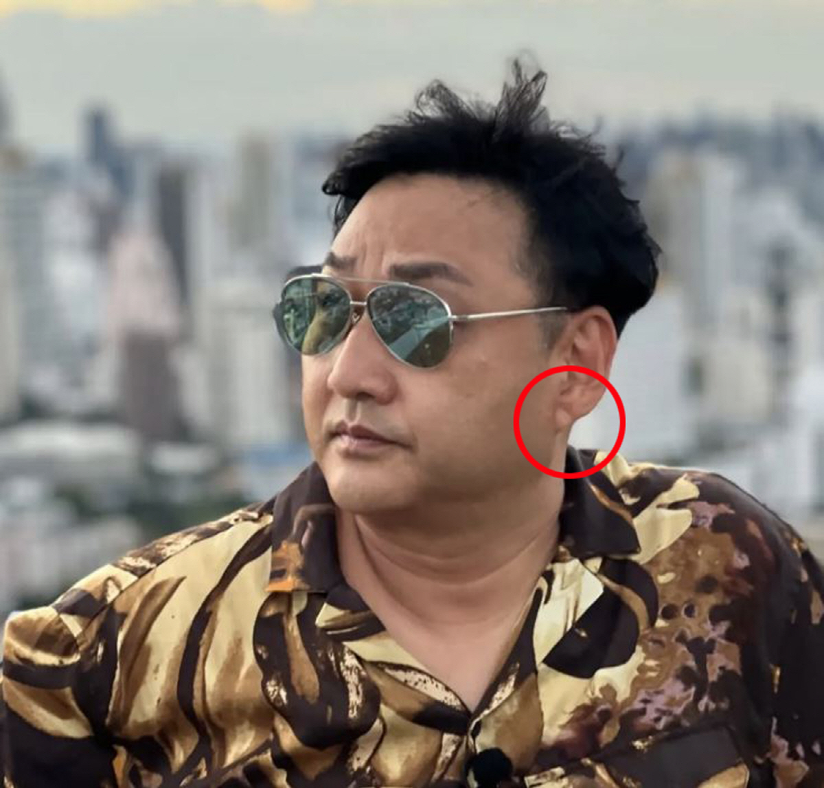 몸이 보내는 질환 '경고 신호'…귓불·손톱에 이러 변화가?