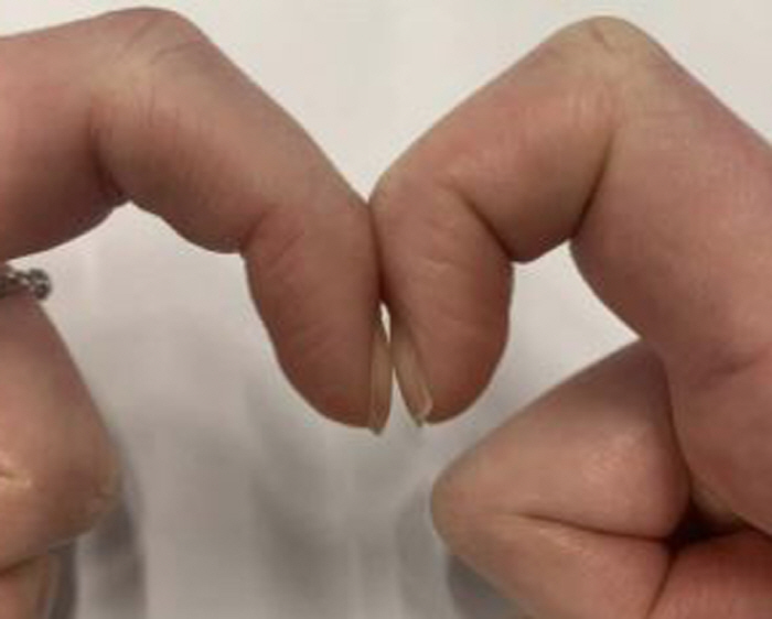 몸이 보내는 질환 '경고 신호'…귓불·손톱에 이러 변화가?