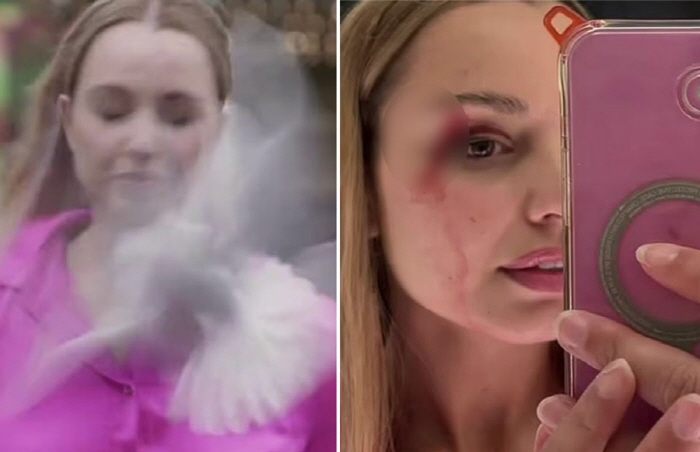 생방송 여기자 얼굴에 갈매기 충돌, 피 '줄줄'…"안경이 필요한 듯"