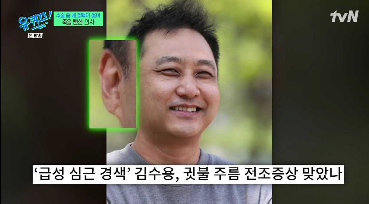 김수용 귓불주름, 심근경색 전조증상 아니었다..유재석 교수 "노화 현상"…