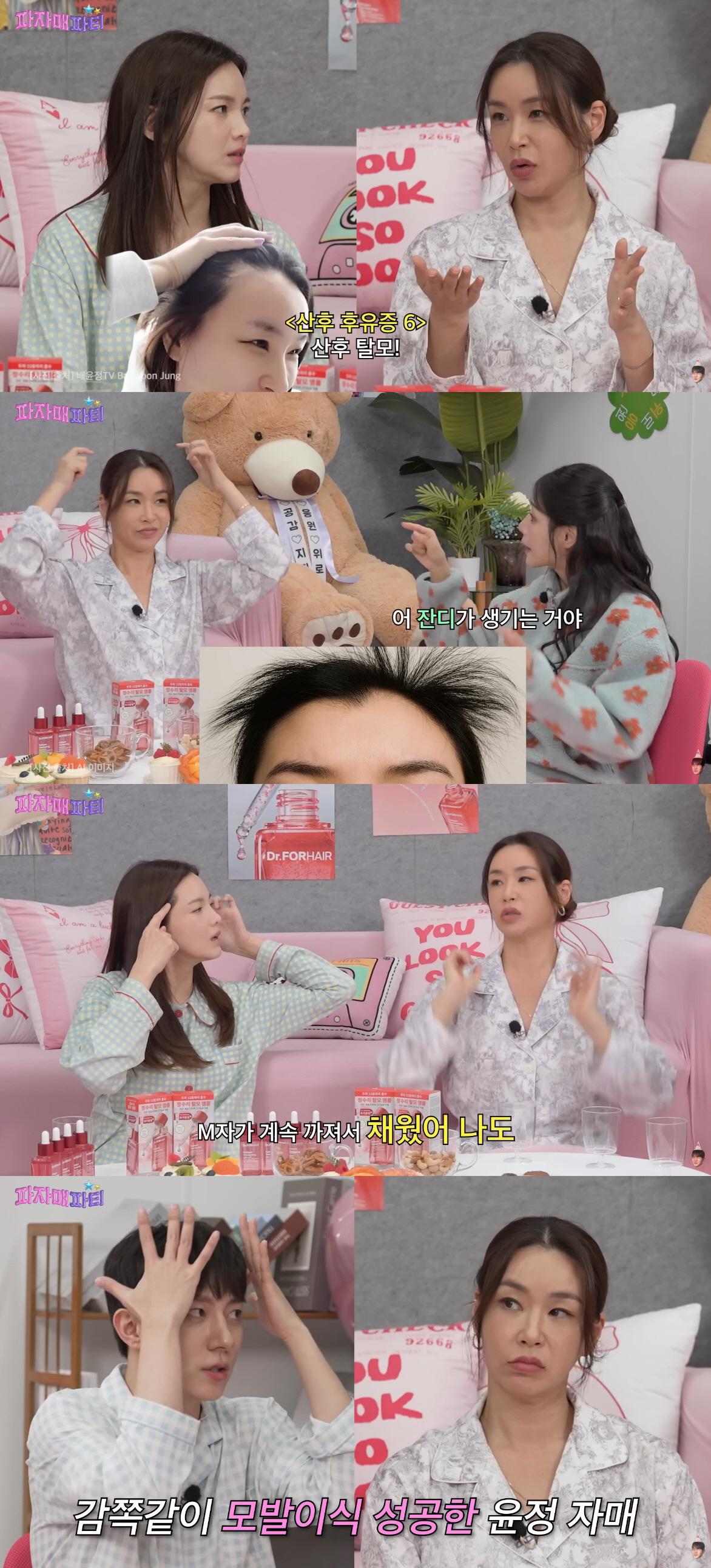 배윤정, 심각한 M자 탈모에 모발 이식 "감쪽같아서 만족"