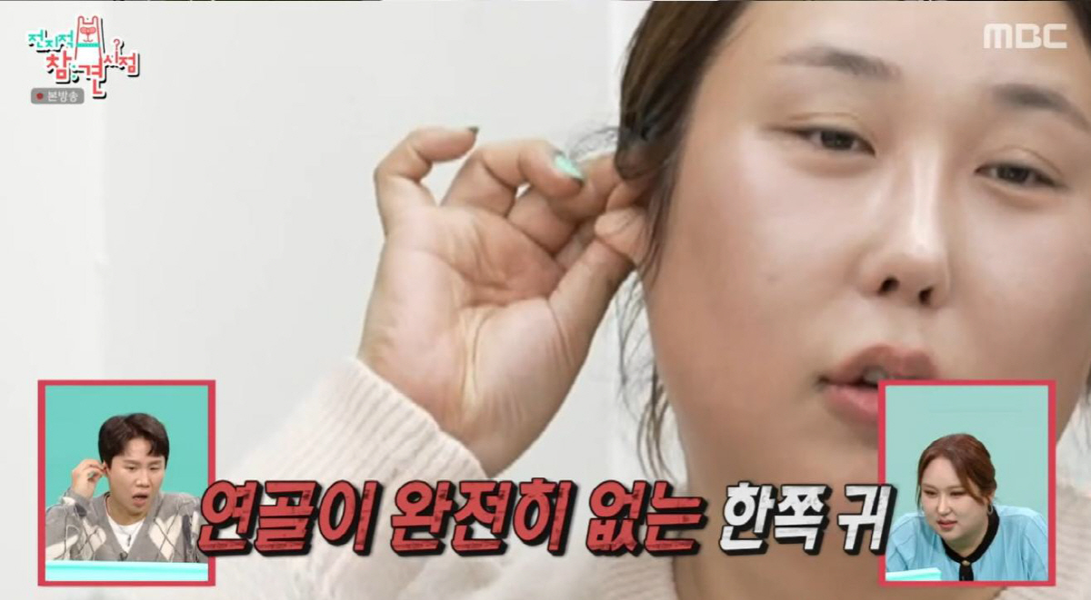 위고비로 25kg 뺀 풍자, 코 수술만 5번 "눈썹 뼈 갈고, 연골도 없…