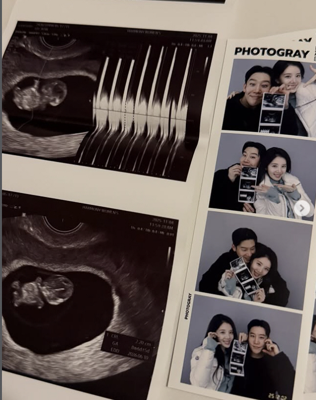 비혼·딩크 외쳤는데...'골때녀' 이주리 "임신했어요" 깜짝 발표