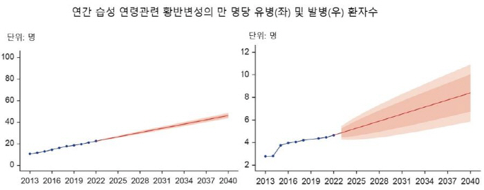 "2040년 시각 장애 유발 습성 연령관련 황반변성 환자 37만 4천명" 예측