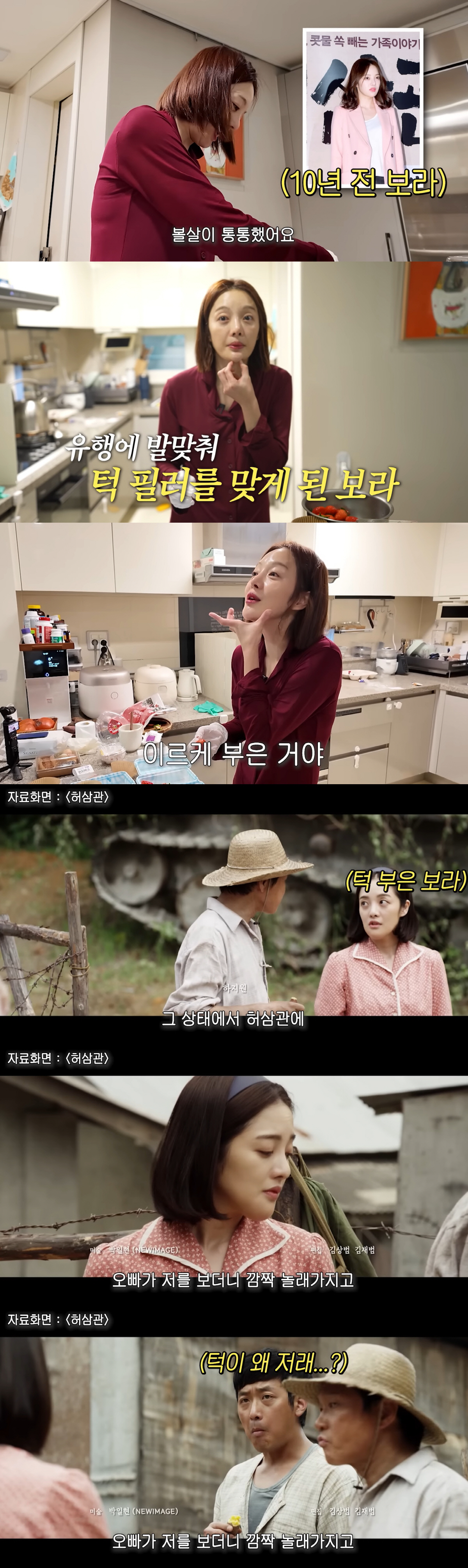 황보라, 턱 필러 잘못 맞아 하관 2배 됐다 "부작용으로 참사"