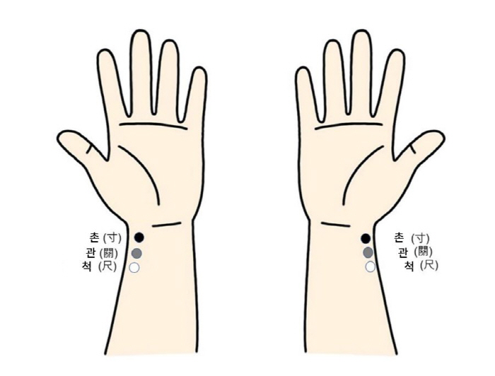 아픈 곳 '반대편'에 침 놓는 이유, 과학적 근거 나왔다