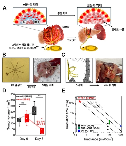KAIST, 문어다리처럼 감싸 췌장암만 정밀 제거 LED 개발