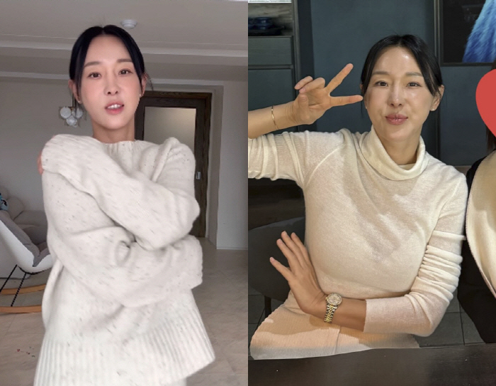 이지혜, 인중축소술 1달만 드디어 입 닫혔다 "축하해줘요"