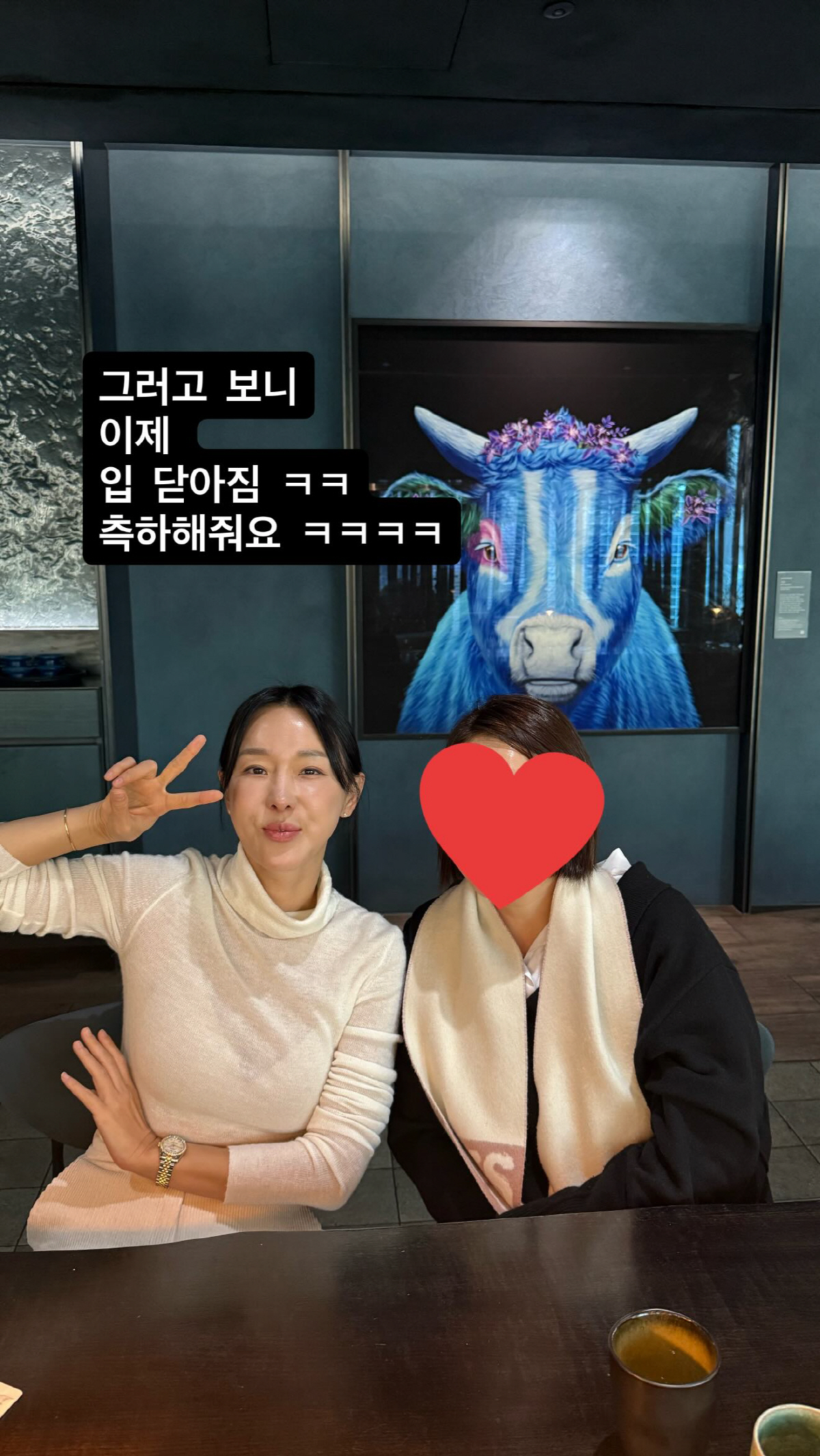 이지혜, 인중축소술 1달만 드디어 입 닫혔다 "축하해줘요"