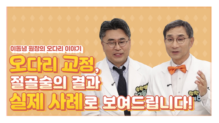 힘찬병원 유튜브 통해 '휘어진 오다리 교정 및 치료법' 공개