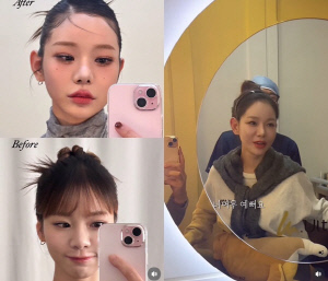 맹승지, '인중 리프팅' 후 확 달라진 얼굴 