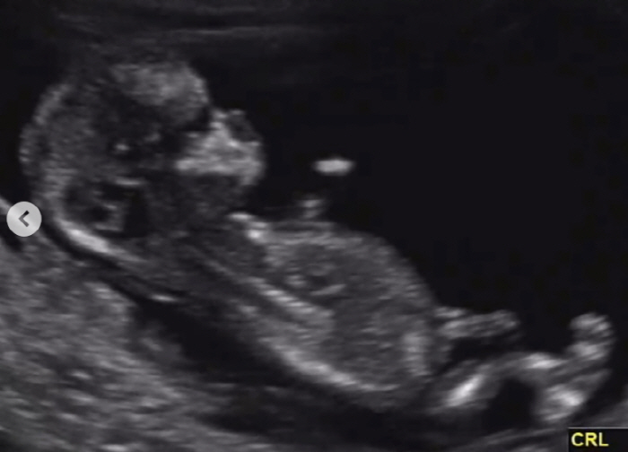 '최현석 딸' 최연수, 결혼 3개월 만 초고속 임신 "예쁘게 봐주세요"