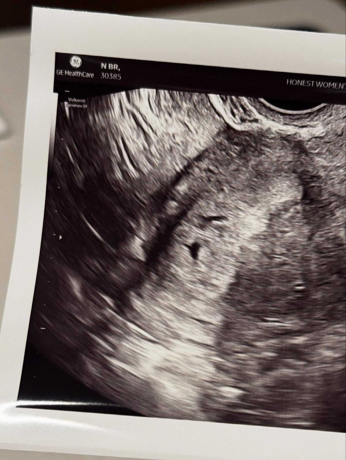 남보라, '임신 12주차'인데 독감 기운 어쩌나..."몸 아픈 것 같아 …