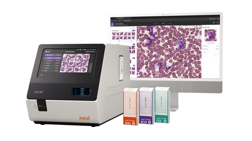 [바이오스냅] 노을, 동유럽에 AI 기반 혈액 분석 플랫폼 공급