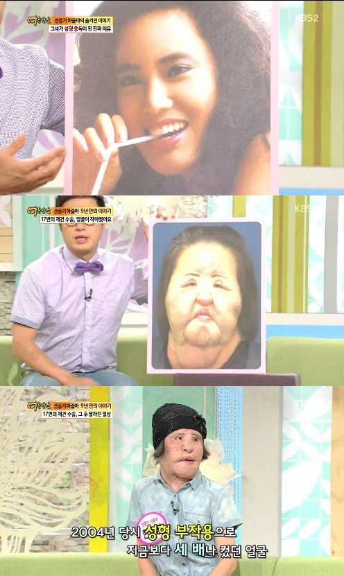 '선풍기 아줌마' 故 한혜경, 불법 성형이 망가뜨린 인생...'향년 57…