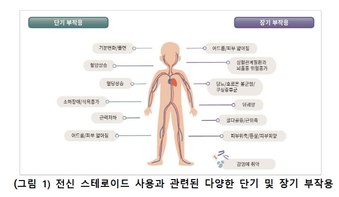 중증 천식 환자, 전신 스테로이드 장기 사용 부작용 우려…국내 환자 적용…