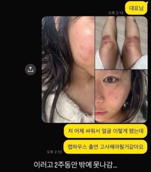 [종합] "부엌 칼로 위협..이러다 죽을 수도"…재키와이, 벼랑 끝에 몰…