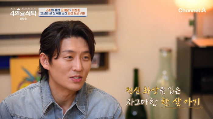 고준, '전신 화상 트라우마' 고백 "괴물이라 불리며 돌 맞았다"