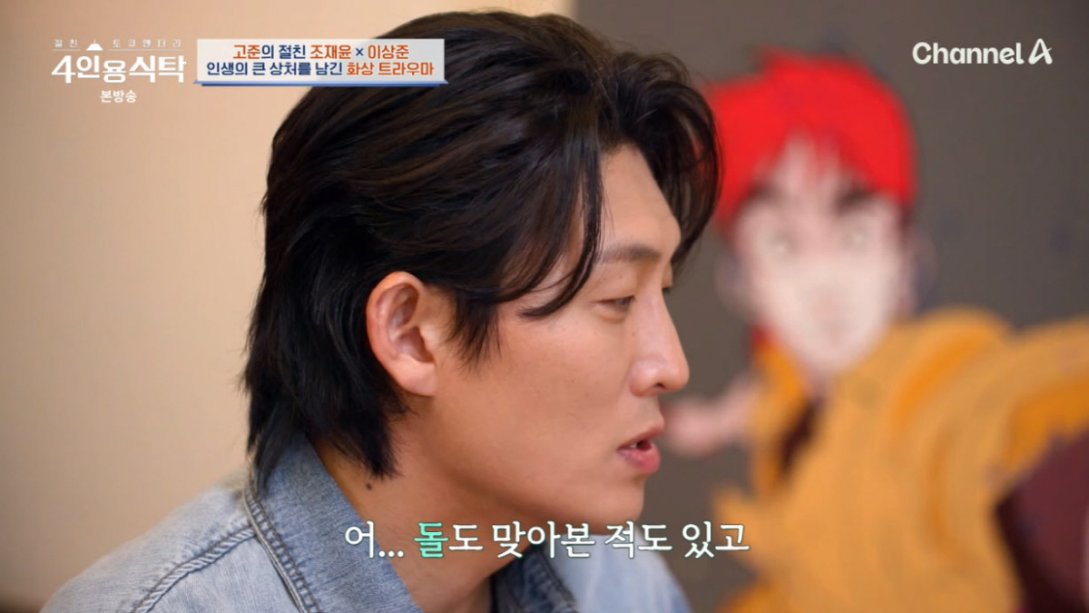 고준, '전신 화상 트라우마' 고백 "괴물이라 불리며 돌 맞았다"