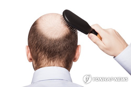 [특징주] 탈모주, 李대통령 "탈모약, 건보 적용 검토" 발언에 강세