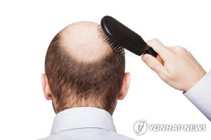 [특징주] 탈모주, 李대통령 