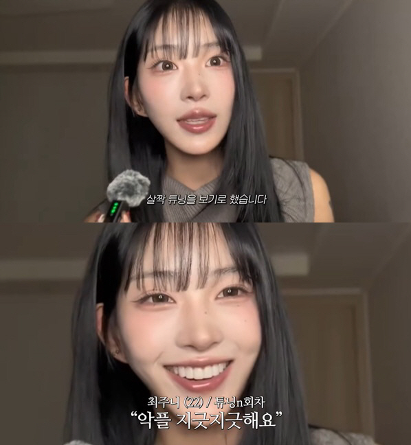 '최진실 딸' 최준희, 눈·코→안면윤곽 이어 또 성형 "악플은 그만"