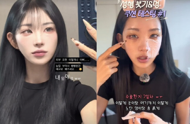 '최진실 딸' 최준희, 눈·코→안면윤곽 이어 또 성형 "악플은 그만"