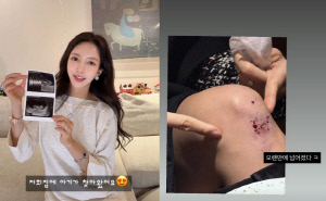 '이필립♥' 박현선, 셋째 임신 중 넘어지는 아찔 사고 