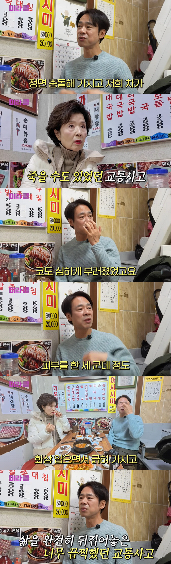 '임꺽정' 김홍표, 정면충돌 교통사고로 심각 "고관절 탈구·얼굴 박피까지…