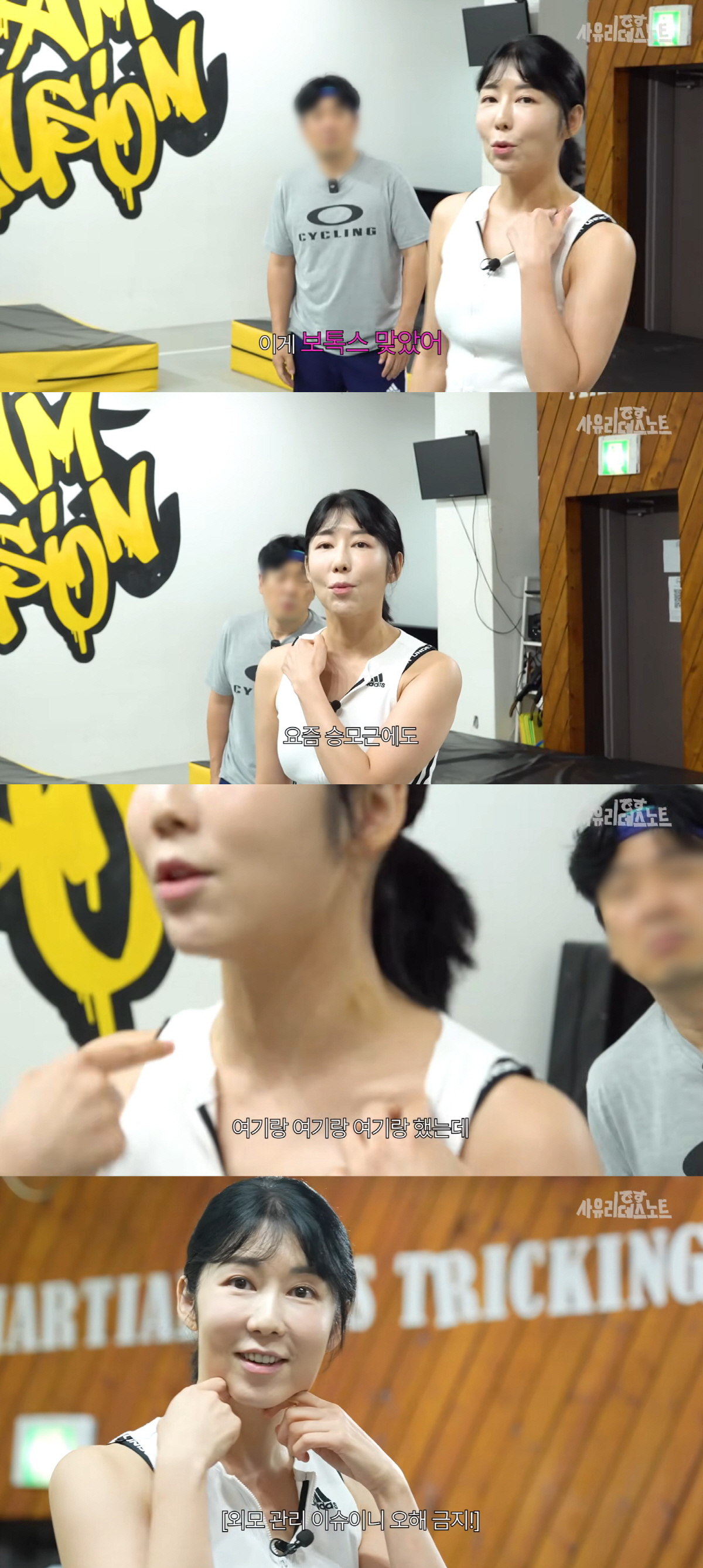 ‘비혼모’ 사유리, '승모근 보톡스' 맞고 확 달라졌다 “얼굴 작아 보여…