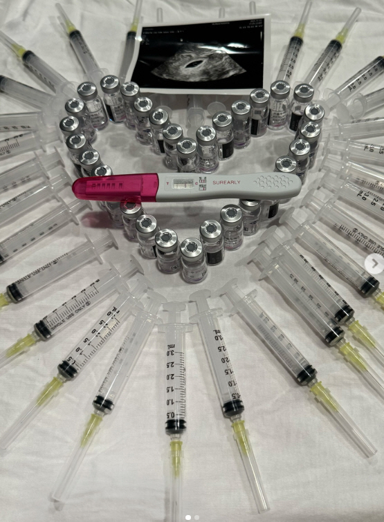 '이지훈♥' 아야네, 시험관 끝에 맞은 이별…둘째 유산 고백