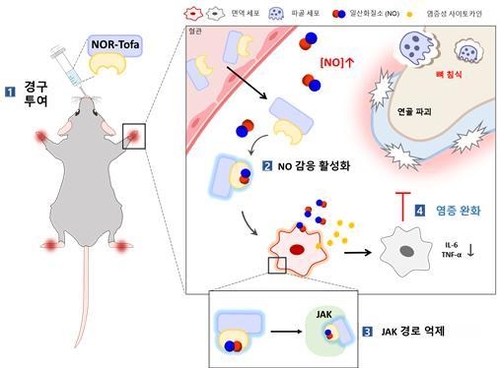 부작용 줄인 관절염 치료제 나왔다…"아픈 관절에만 약효"