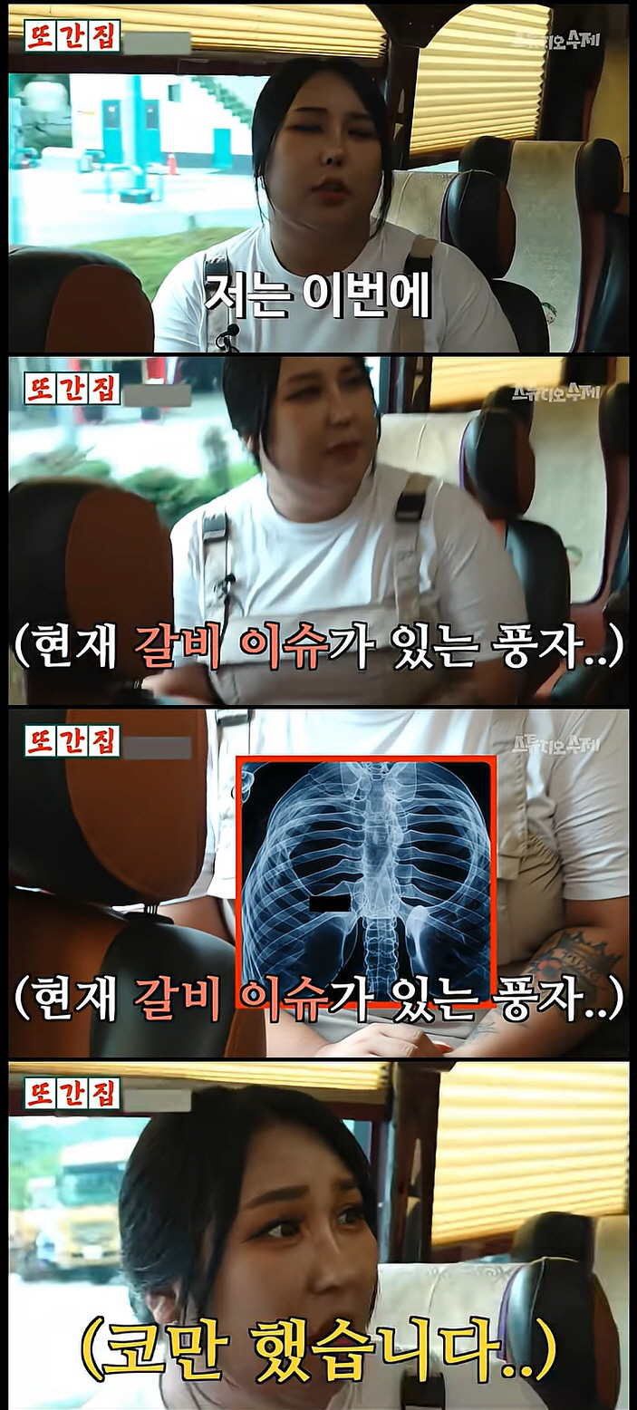 풍자, 갈비뼈 빼서 5번째 코 수술 "더 이상 몸에서 쓸 수 있는 게 없…