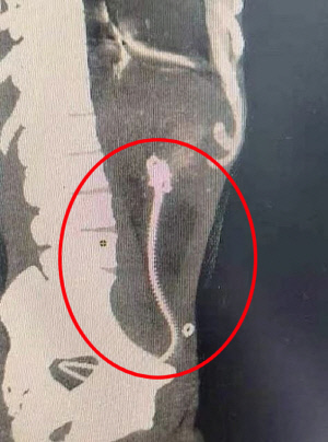 배 안에서 길이 30cm 장어 '꿈틀'…어떻게 들어갔을까?