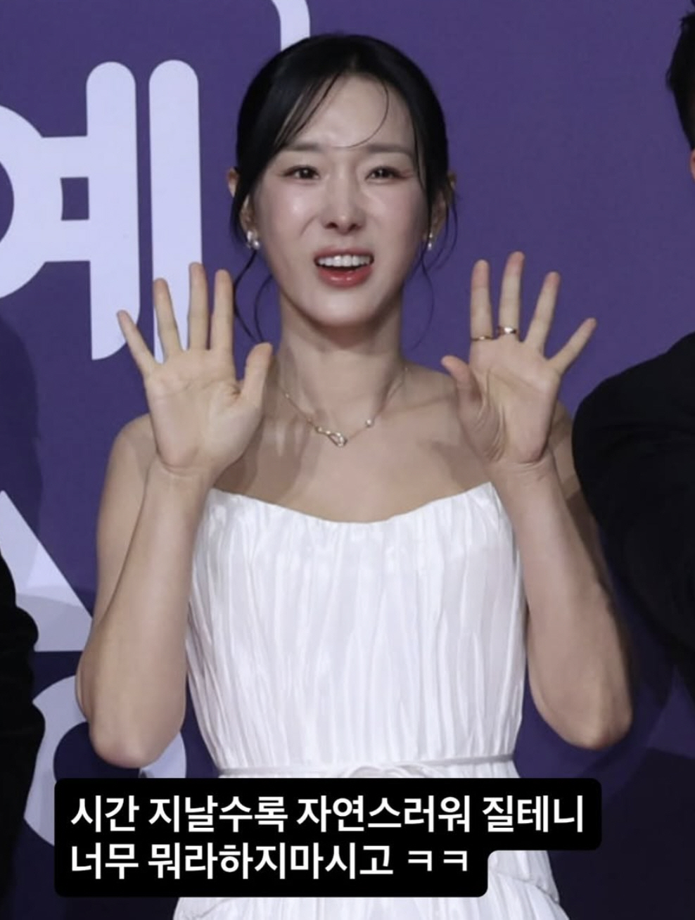 이지혜, 결국 '인중축소술' 이슈에 씁쓸함 토로 "너무 뭐라하지 마시라"