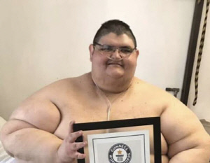 체중 590kg '세계에서 가장 비만한 남성' 41세로 세상 떠나