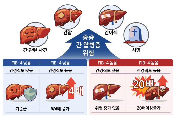 "대사이상 지방간 환자, 간경직도 높으면 합병증 위험 최대 20배 높아"