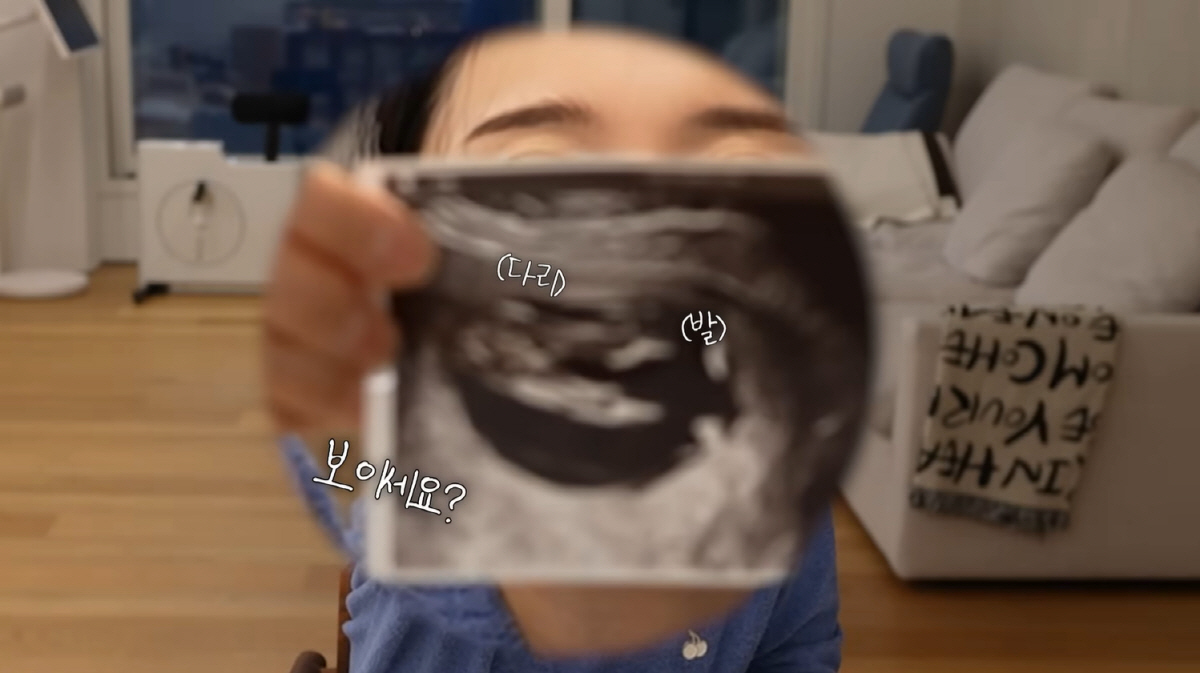 '임신' 남보라, 호르몬 박살났다..."우울하고 내 자신 없어져" ('인…